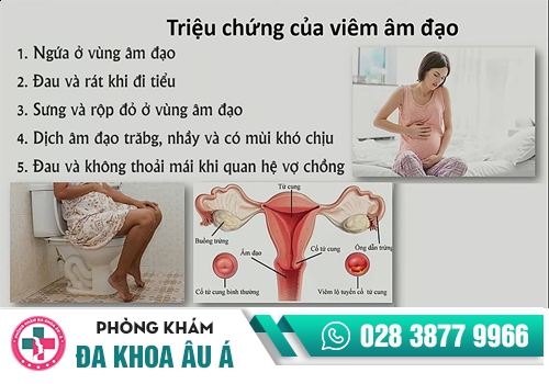 QUAN HỆ RA MÁU DO ĐÂU?